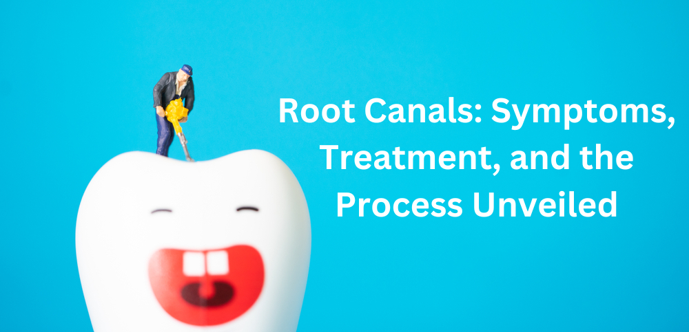 Root Canals: Symptoms, Treatment, and the Process